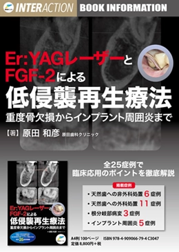 Er:YAGレーザーとFGF-2による低侵襲再生療法