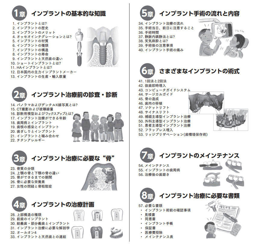 インプラントガイドブック目次